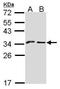 CD159a antibody, TA308317, Origene, Western Blot image 