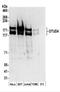 OTU Deubiquitinase 4 antibody, NBP2-37689, Novus Biologicals, Western Blot image 