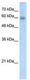 REST Corepressor 2 antibody, TA337282, Origene, Western Blot image 