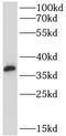 Clathrin Light Chain A antibody, FNab01777, FineTest, Western Blot image 