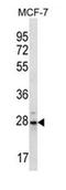 Proteasome Subunit Beta 10 antibody, AP53486PU-N, Origene, Western Blot image 