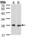 DnaJ homolog subfamily B member 6 antibody, TA308430, Origene, Western Blot image 