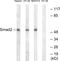 SMAD2 antibody, LS-C117927, Lifespan Biosciences, Western Blot image 