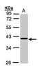 Ankyrin Repeat And SOCS Box Containing 4 antibody, PA5-21834, Invitrogen Antibodies, Western Blot image 