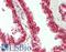 Ribosome Binding Protein 1 antibody, LS-B14197, Lifespan Biosciences, Immunohistochemistry paraffin image 