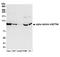 ACTN4 antibody, A304-768A, Bethyl Labs, Western Blot image 
