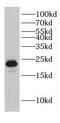 Dermatopontin antibody, FNab02338, FineTest, Western Blot image 