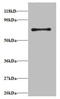 Ribosomal Protein S18 antibody, A51757-100, Epigentek, Western Blot image 