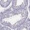 Armadillo Repeat Containing 2 antibody, NBP1-88730, Novus Biologicals, Immunohistochemistry paraffin image 