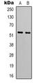 Gastric Inhibitory Polypeptide Receptor antibody, LS-C368980, Lifespan Biosciences, Western Blot image 