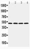 Hyaluronidase 1 antibody, PA5-79421, Invitrogen Antibodies, Western Blot image 