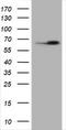 Heat Shock Protein Family D (Hsp60) Member 1 antibody, TA800772AM, Origene, Western Blot image 