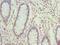 Cysteine desulfurase, mitochondrial antibody, LS-C676158, Lifespan Biosciences, Immunohistochemistry paraffin image 