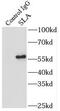 LP antibody, FNab07899, FineTest, Immunoprecipitation image 