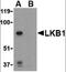 Serine/Threonine Kinase 11 antibody, orb86789, Biorbyt, Western Blot image 