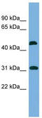 CTD Small Phosphatase 2 antibody, TA340071, Origene, Western Blot image 