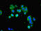 LHRHR antibody, LS-C369915, Lifespan Biosciences, Immunofluorescence image 
