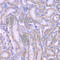 Acetyl-CoA Acyltransferase 1 antibody, A7422, ABclonal Technology, Immunohistochemistry paraffin image 