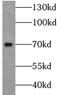 Baculoviral IAP Repeat Containing 3 antibody, FNab01706, FineTest, Western Blot image 