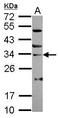 Zinc finger protein SNAI3 antibody, GTX122344, GeneTex, Western Blot image 