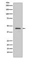 Non-structural protein V antibody, MT0013, Boster Biological Technology, Western Blot image 