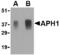 Aph-1 Homolog A, Gamma-Secretase Subunit antibody, TA306378, Origene, Western Blot image 