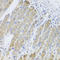 Arginyl-TRNA Synthetase 2, Mitochondrial antibody, A10485, Boster Biological Technology, Immunohistochemistry paraffin image 