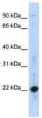 Cysteine Rich Protein 2 antibody, TA335870, Origene, Western Blot image 