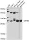 Glycoprotein Ib Platelet Subunit Beta antibody, 13-437, ProSci, Western Blot image 