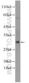 Single-Pass Membrane Protein With Coiled-Coil Domains 1 antibody, 25362-1-AP, Proteintech Group, Western Blot image 
