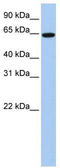 EPS8 Like 1 antibody, TA344143, Origene, Western Blot image 