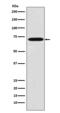 Lymphocyte Cytosolic Protein 1 antibody, M03361-1, Boster Biological Technology, Western Blot image 