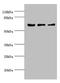 Kinesin Light Chain 1 antibody, LS-C675952, Lifespan Biosciences, Western Blot image 