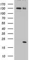 Interleukin 2 antibody, M00387-1, Boster Biological Technology, Western Blot image 