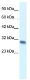 Four And A Half LIM Domains 2 antibody, TA335334, Origene, Western Blot image 