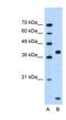 FXYD Domain Containing Ion Transport Regulator 5 antibody, NBP1-59137, Novus Biologicals, Western Blot image 