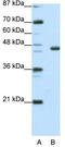 Early growth response protein 4 antibody, TA335212, Origene, Western Blot image 