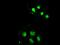 Small RNA Binding Exonuclease Protection Factor La antibody, MA5-24922, Invitrogen Antibodies, Immunocytochemistry image 