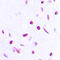 Tumor Protein P63 antibody, LS-C358372, Lifespan Biosciences, Immunohistochemistry paraffin image 