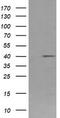 Fc Fragment Of IgG Receptor Ia antibody, TA506343BM, Origene, Western Blot image 