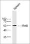 RELB Proto-Oncogene, NF-KB Subunit antibody, orb4793, Biorbyt, Western Blot image 