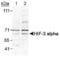 HIF3-alpha-1 antibody, PA1-16952, Invitrogen Antibodies, Western Blot image 