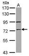 Zinc Finger Protein 530 antibody, PA5-32092, Invitrogen Antibodies, Western Blot image 