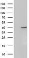 Sterol O-acyltransferase 2 antibody, TA501218, Origene, Western Blot image 