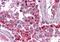 BIRC3 antibody, orb92409, Biorbyt, Immunohistochemistry paraffin image 