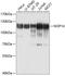 NOP14 Nucleolar Protein antibody, A09101, Boster Biological Technology, Western Blot image 