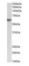 Fibrinogen Beta Chain antibody, orb178378, Biorbyt, Western Blot image 