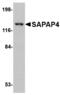 DLG Associated Protein 4 antibody, MBS151064, MyBioSource, Western Blot image 