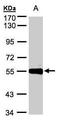 Carboxypeptidase M antibody, TA308290, Origene, Western Blot image 