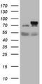 Galactosidase Beta 1 antibody, TA505442S, Origene, Western Blot image 